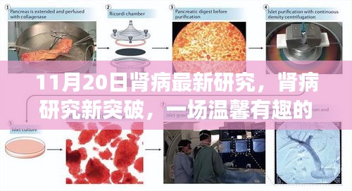 肾病研究新突破，温馨有趣的医学之旅（11月20日更新）