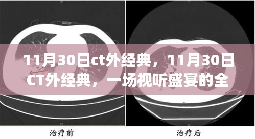 11月30日CT外经典，全方位解读视听盛宴