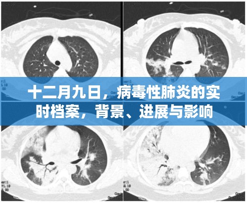 十二月九日，病毒性肺炎实时档案揭秘——背景、进展与影响全解析