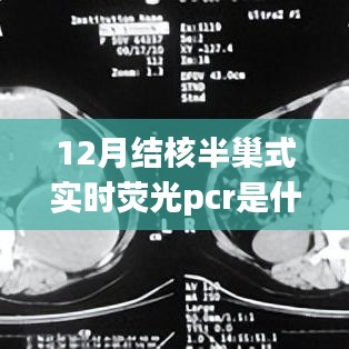 深度解析，12月结核半巢式实时荧光PCR的特性、应用及原理